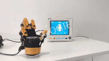 Handrehabilitation nach Schlaganfall